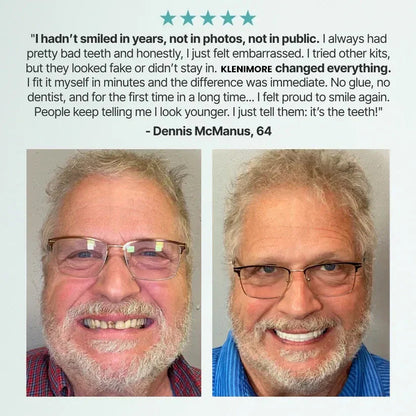 🌎Ends Today: 70% OFF! ⏰PRIMAION™ Medical Full Denture with Strong Suction